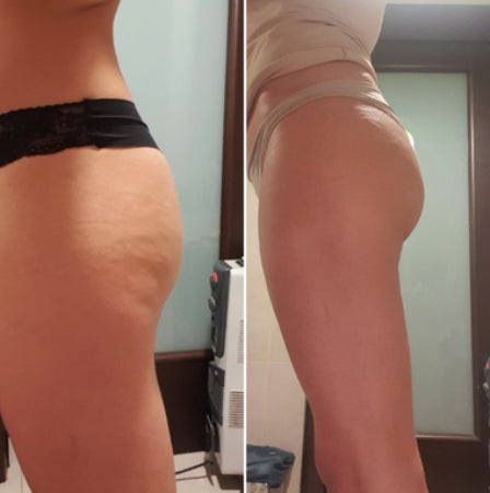 Velora Oil | Tightens and lifts sagging skin by 98% within 24 hours