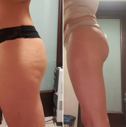 Velora Oil | Tightens and lifts sagging skin by 98% within 24 hours