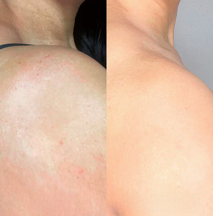 Velora Oil | Tightens and lifts sagging skin by 98% within 24 hours