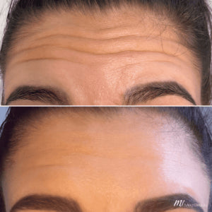 Velora Oil | Tightens and lifts sagging skin by 98% within 24 hours