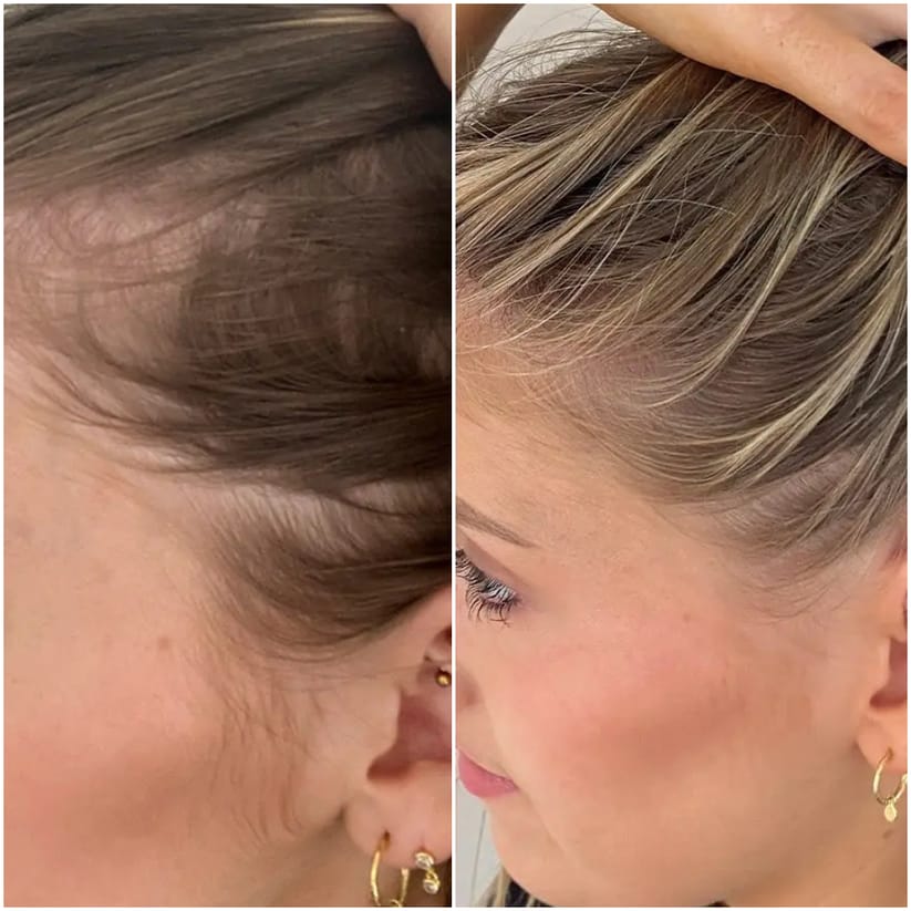 Velora® Hair Growth Gummies