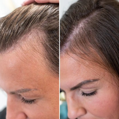 Velora® Hair Growth Gummies