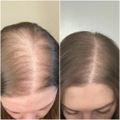 Velora® Hair Growth Gummies