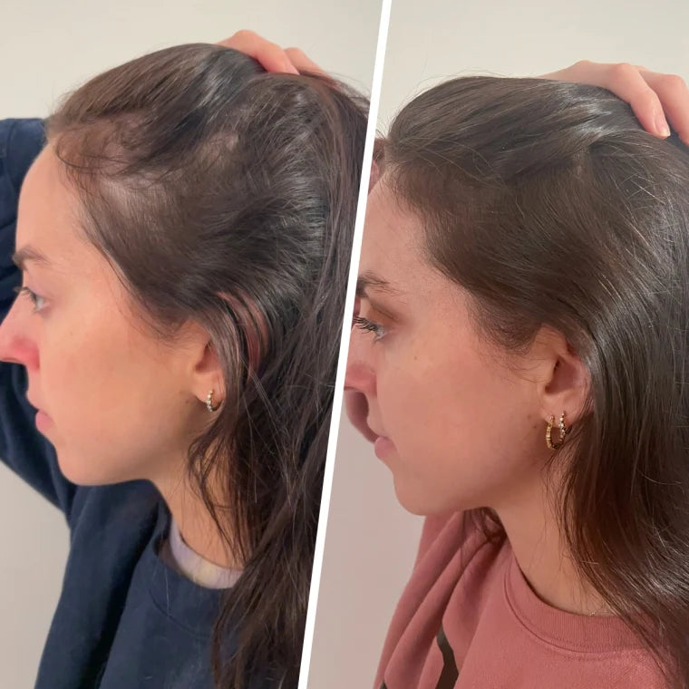 Velora® Hair Growth Gummies