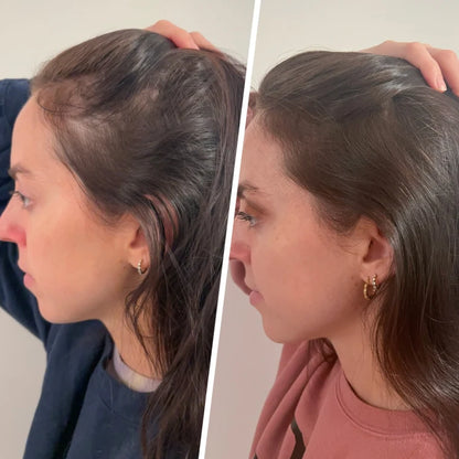 Velora® Hair Growth Gummies